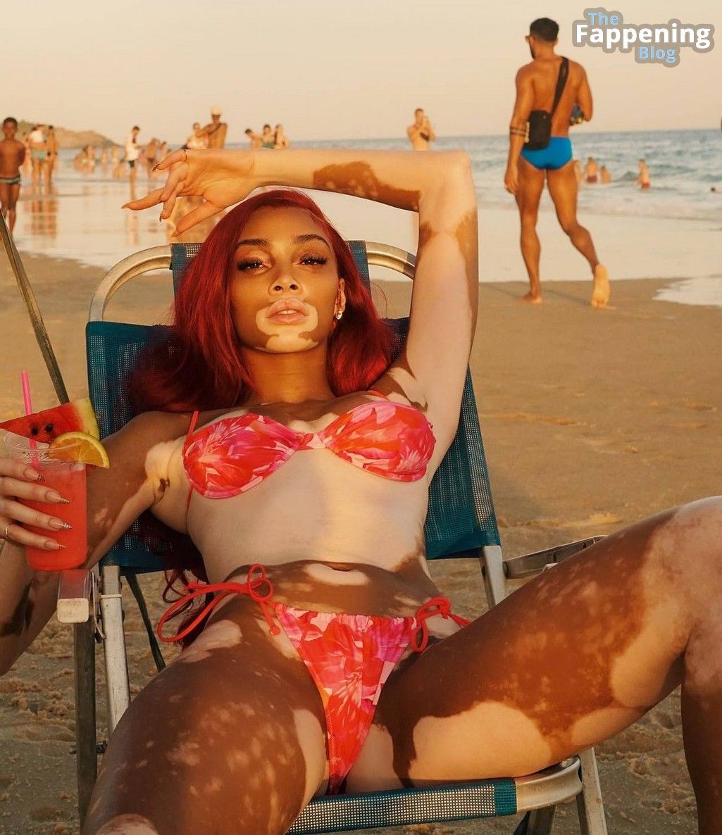 Winnie Harlow Sexy (28 Photos) - OnlyFans Leaked Nudes